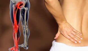 Características da dor nas costas
