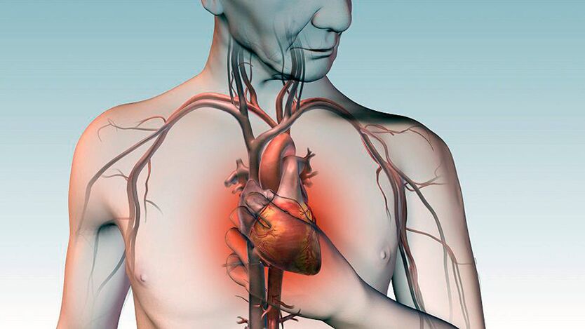 Dor sob a escápula e dor intensa atrás do esterno com doença cardíaca