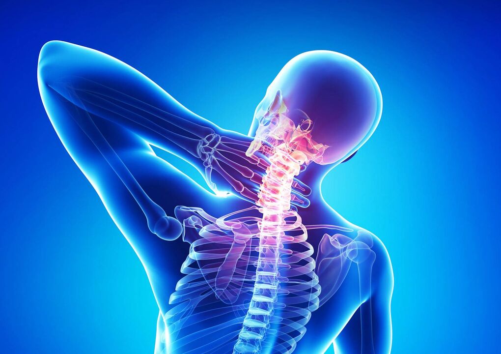 Osteocondrose do pescoço