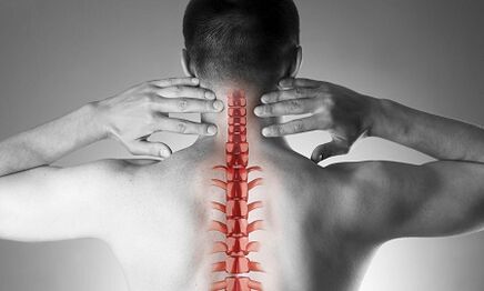 Como se manifesta a osteocondrose da coluna cervical