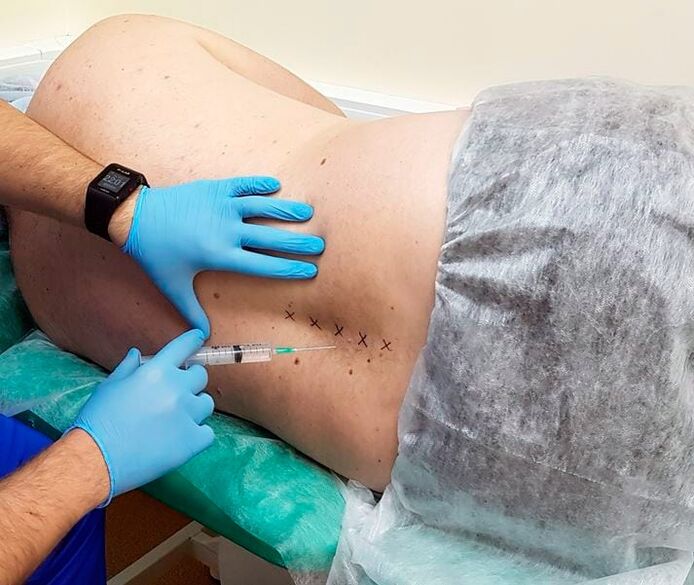bloqueios medicinais para as costas